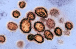 20200227170638583_preview Das Virus, das die Krankheit Covid-19 verursacht.