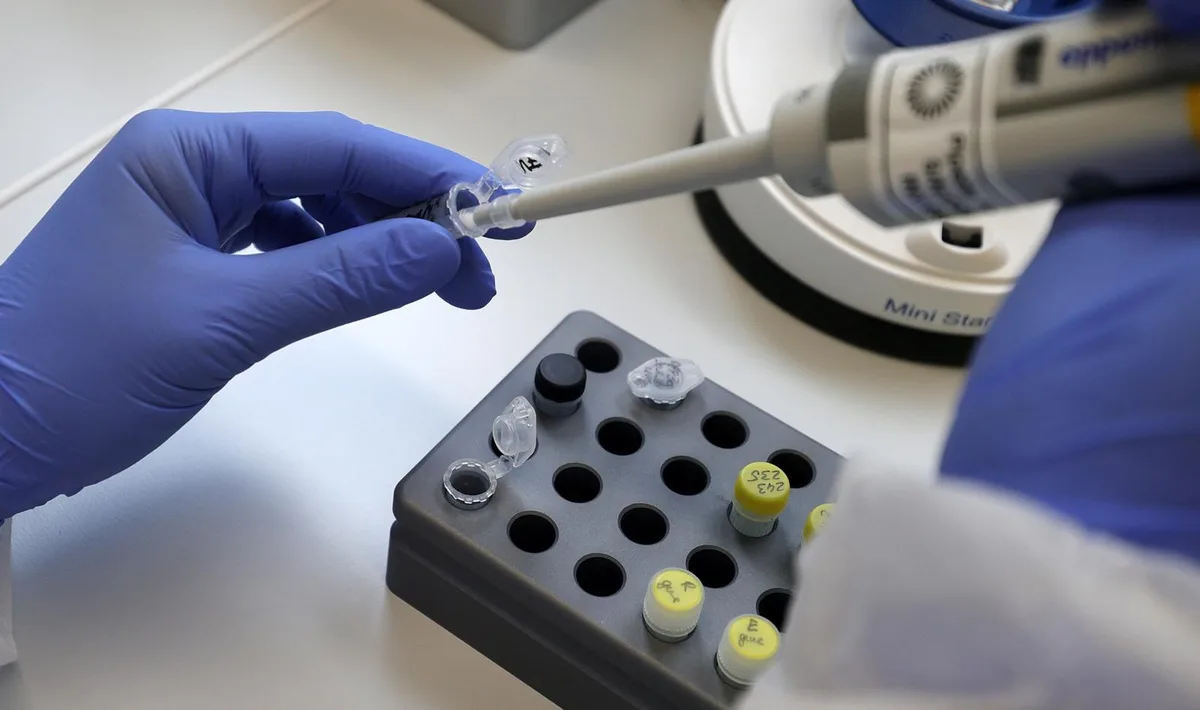 20200630182833165_preview Dem Virus auf der Spur: Weltweit wird an der Entwicklung eines Impfstoffs gearbeitet (Foto: Keystone)