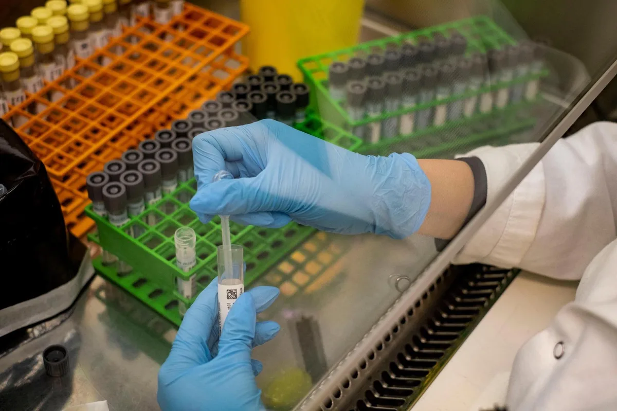 Die Proben müssen mittels Pipette ins Laborröhrchen umgefüllt werden. Eine Corona-Probe wird ausgewertet.