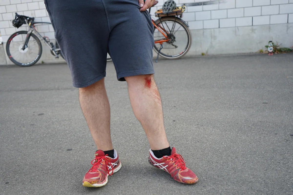 Ein blutiges Knie