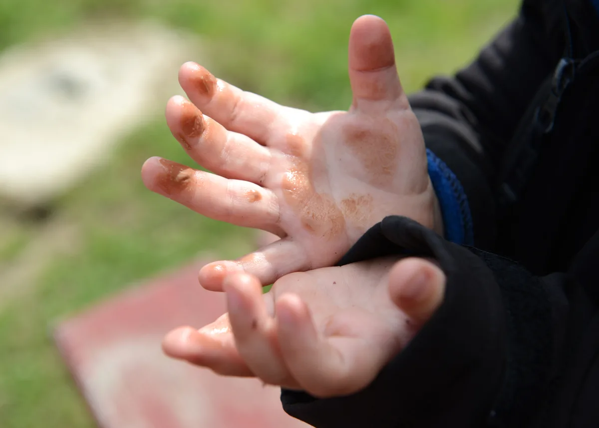 Bei den warmen Temperaturen schmolz die Schoggi bereits in den Händen. Man sieht Kinderhände mit Schokoladenresten.