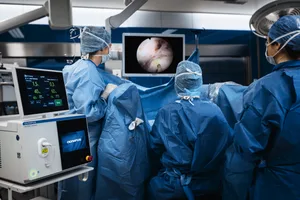 Der Thulium-Faser-Laser verspricht schonende und effiziente Eingriffe. Der Thulium-Faser-Laser verspricht schonende und effiziente Eingriffe.